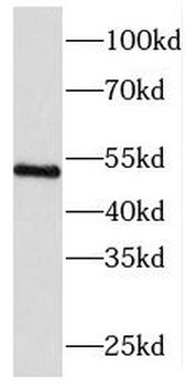 RCC1 Rabbit Polyclonal Antibody