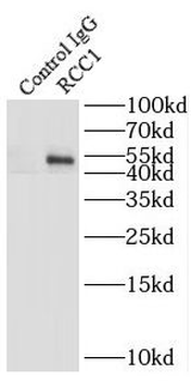 RCC1 Rabbit Polyclonal Antibody