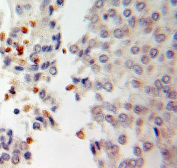 RCC1 Rabbit Polyclonal Antibody