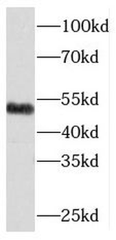 RCC1 Rabbit Polyclonal Antibody