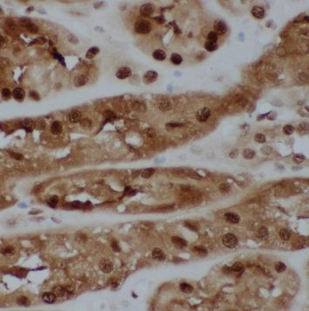 RCC1 Rabbit Polyclonal Antibody