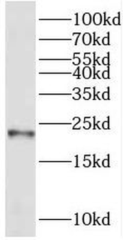 REEP1 Rabbit Polyclonal Antibody