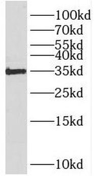 RNLS Rabbit Polyclonal Antibody