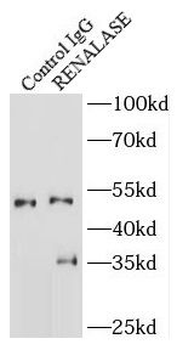 RNLS Rabbit Polyclonal Antibody