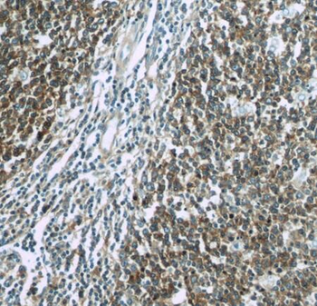 RFTN1 Rabbit Polyclonal Antibody