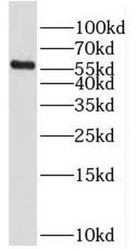RFTN2 Rabbit Polyclonal Antibody