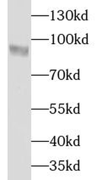 HMMR Rabbit Polyclonal Antibody