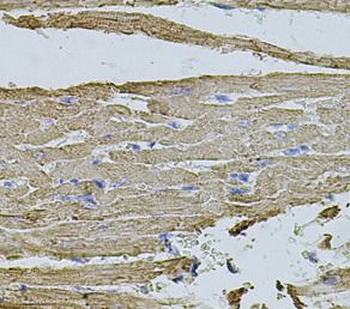 HMMR Rabbit Polyclonal Antibody