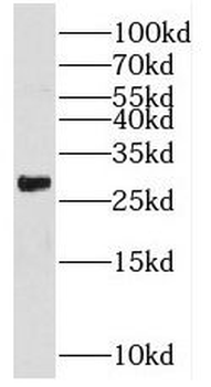 RHOT2 Rabbit Polyclonal Antibody