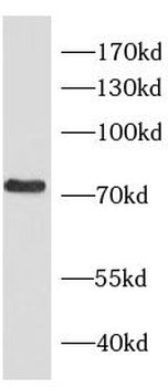 RHOT2 Rabbit Polyclonal Antibody