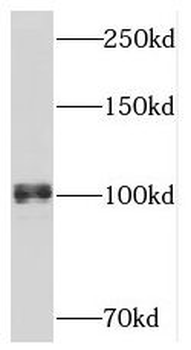 APBB1IP Rabbit Polyclonal Antibody