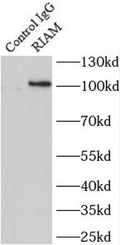 APBB1IP Rabbit Polyclonal Antibody