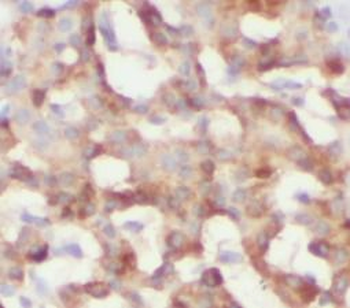 RIPK3 Rabbit Polyclonal Antibody