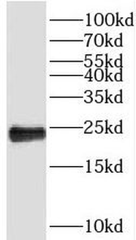 PEBP1 Rabbit Polyclonal Antibody