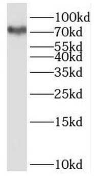 URI1 Rabbit Polyclonal Antibody