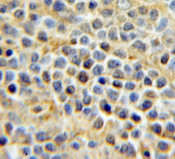 URI1 Rabbit Polyclonal Antibody