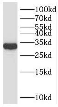 RNASEH1 Rabbit Polyclonal Antibody