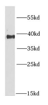 RNF2 Rabbit Polyclonal Antibody