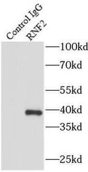 RNF2 Rabbit Polyclonal Antibody