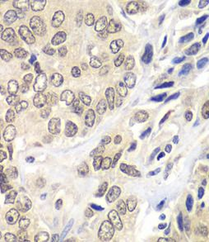 RNF2 Rabbit Polyclonal Antibody