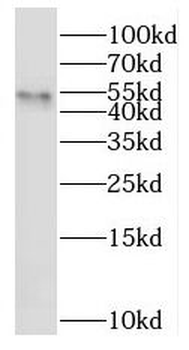 RNF25 Rabbit Polyclonal Antibody