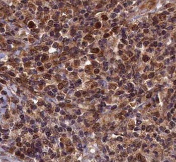 RNF25 Rabbit Polyclonal Antibody
