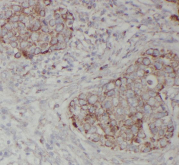 RNF34 Rabbit Polyclonal Antibody