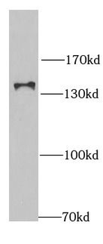 RNF40 Rabbit Polyclonal Antibody