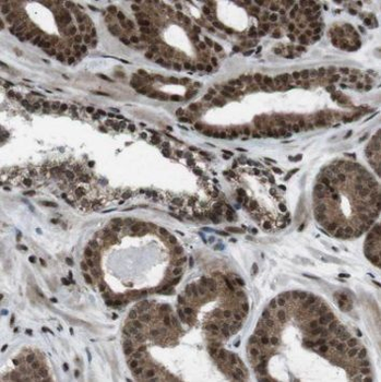 RNF40 Rabbit Polyclonal Antibody
