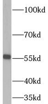 RNMT Rabbit Polyclonal Antibody