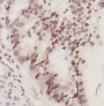 RNMT Rabbit Polyclonal Antibody