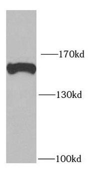 ROCK1 Rabbit Polyclonal Antibody