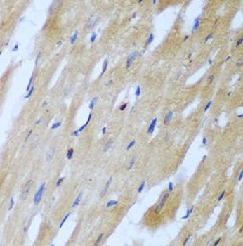 ROCK1 Rabbit Polyclonal Antibody
