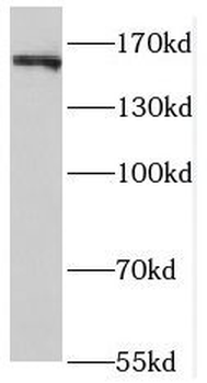 ROCK2 Rabbit Polyclonal Antibody