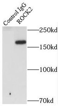 ROCK2 Rabbit Polyclonal Antibody