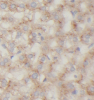 ROCK2 Rabbit Polyclonal Antibody