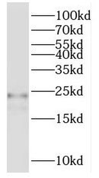 RPL17 Rabbit Polyclonal Antibody