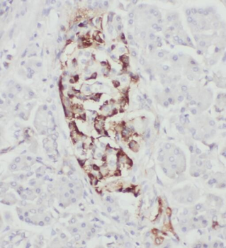RPL17 Rabbit Polyclonal Antibody
