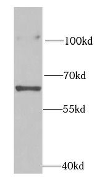RPN2 Rabbit Polyclonal Antibody