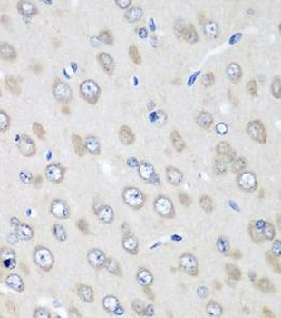RPN2 Rabbit Polyclonal Antibody