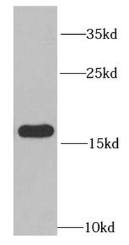 RPS14 Rabbit Polyclonal Antibody
