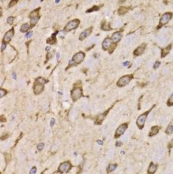 RPS14 Rabbit Polyclonal Antibody