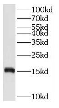 RPS20 Rabbit Polyclonal Antibody