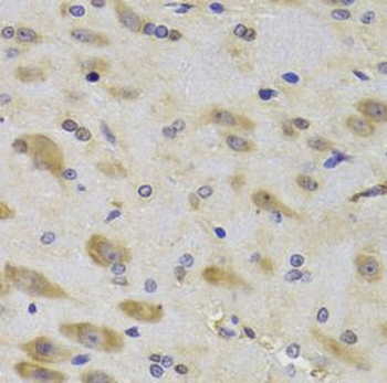 RPS27 Rabbit Polyclonal Antibody