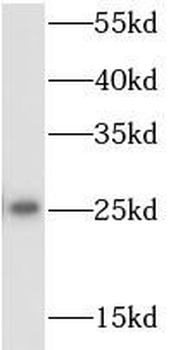 RPS9 Rabbit Polyclonal Antibody