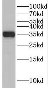 CNOT9 Rabbit Polyclonal Antibody