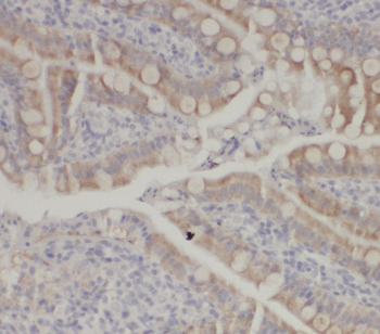 CNOT9 Rabbit Polyclonal Antibody