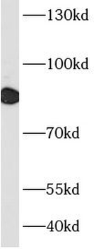 RRM1 Mouse Monoclonal Antibody
