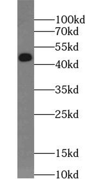 RSAD2 Rabbit Polyclonal Antibody