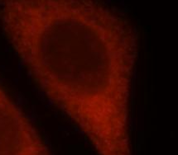 RSAD2 Rabbit Polyclonal Antibody